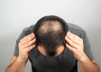 Saç tökülməsinin əsas səbəbləri – Saç niyə tökülür?