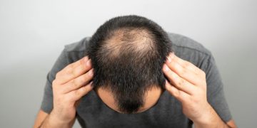 Saç tökülməsinin əsas səbəbləri – Saç niyə tökülür?